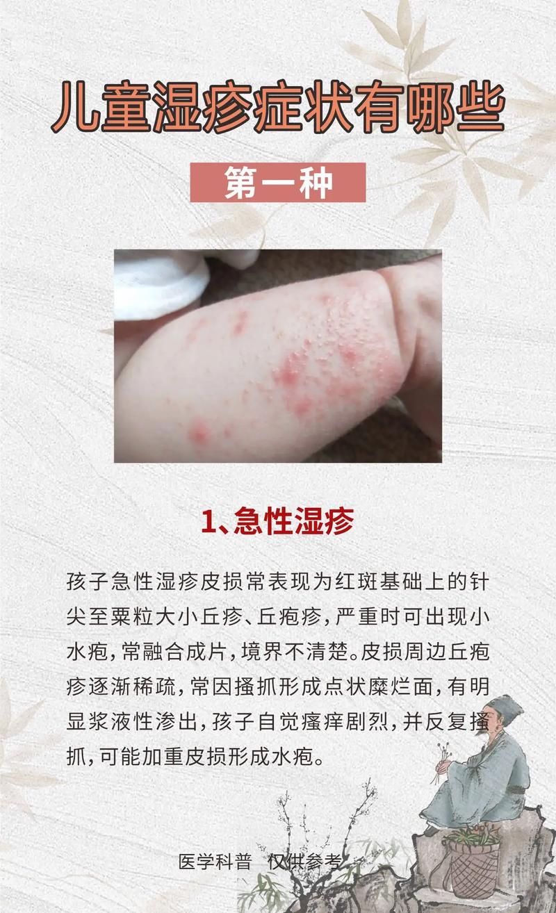 新生儿脸上热出的湿疹怎么护理才能好得快?-第3张图片-郑州医学网 新生儿脸上热出的湿疹怎么护理才能好得快?-第3张图片-郑州医学网