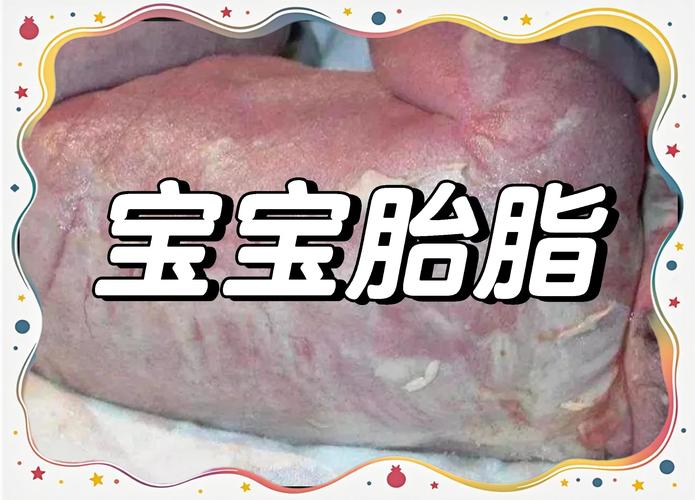 新生儿胎脂多是正常现象还是异常信号？背后原因有哪些？-第2张图片-郑州医学网