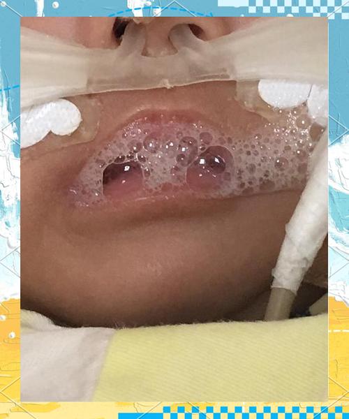 新生儿14天嗓子像有痰是正常现象吗?需要怎么处理?-第3张图片-郑州医学网 新生儿14天嗓子像有痰是正常现象吗?需要怎么处理?-第3张图片-郑州医学网