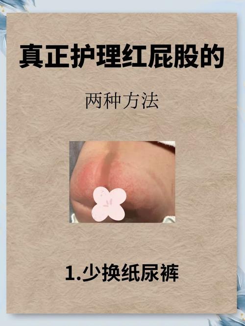 新生儿打屁多是肠胃健康信号还是消化异常表现？-第2张图片-郑州医学网