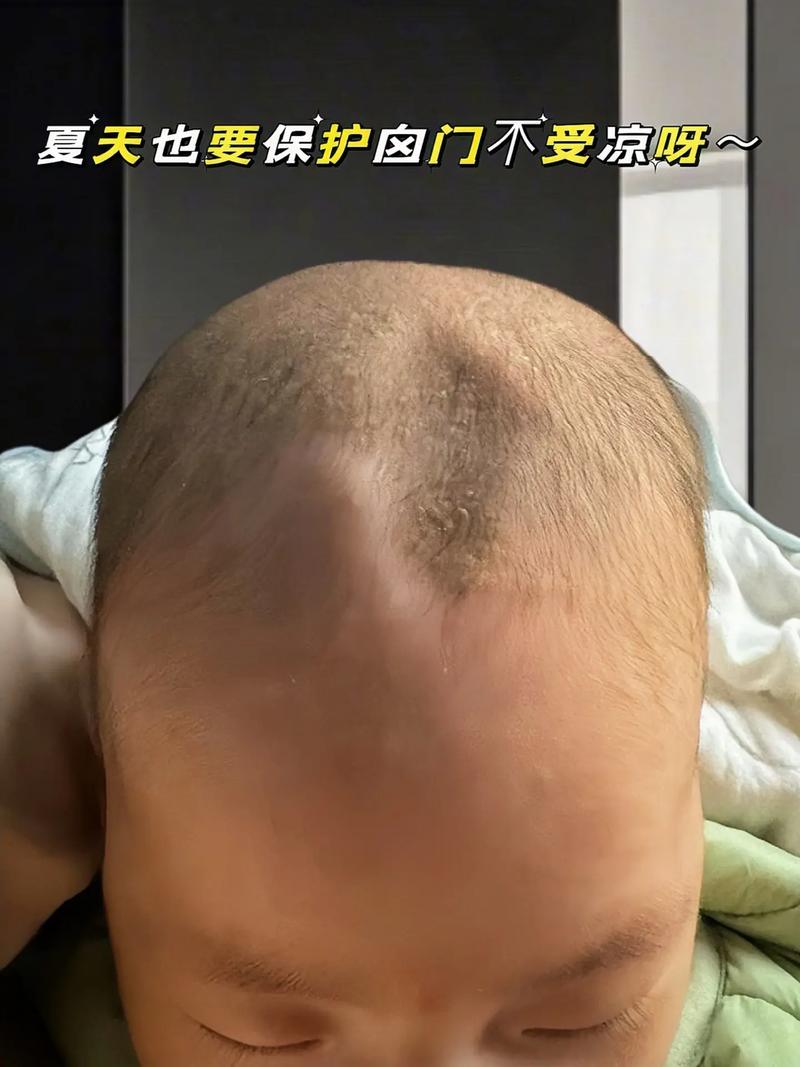 新生儿头顶的软软区域是什么结构，对宝宝发育有何影响？-第2张图片-郑州医学网