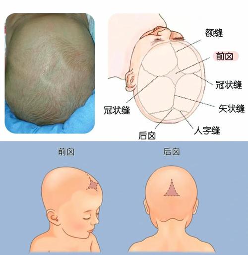 新生儿头顶的软软区域是什么结构，对宝宝发育有何影响？-第1张图片-郑州医学网