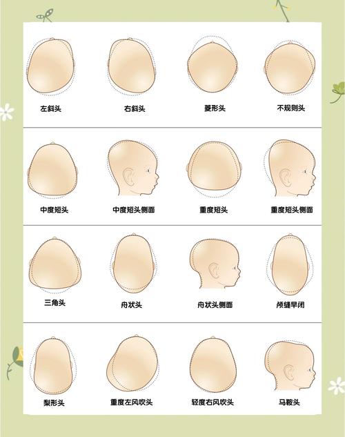 孕期胎儿头偏大就是缺钙？头围大小和缺钙到底有没有直接关系？-第2张图片-郑州医学网