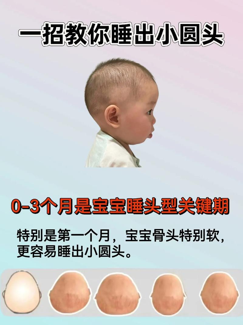 新生儿头型真的是睡出来的吗？科学依据与正确睡姿解析-第2张图片-郑州医学网
