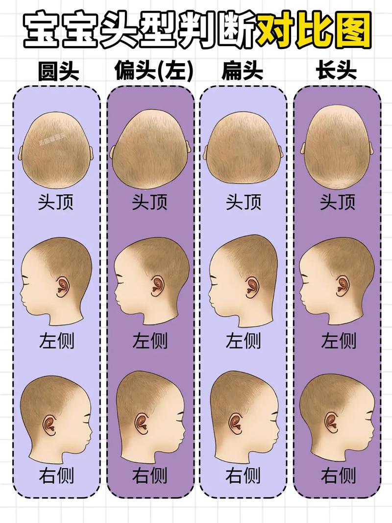 新生儿头型真的是睡出来的吗？科学依据与正确睡姿解析-第1张图片-郑州医学网