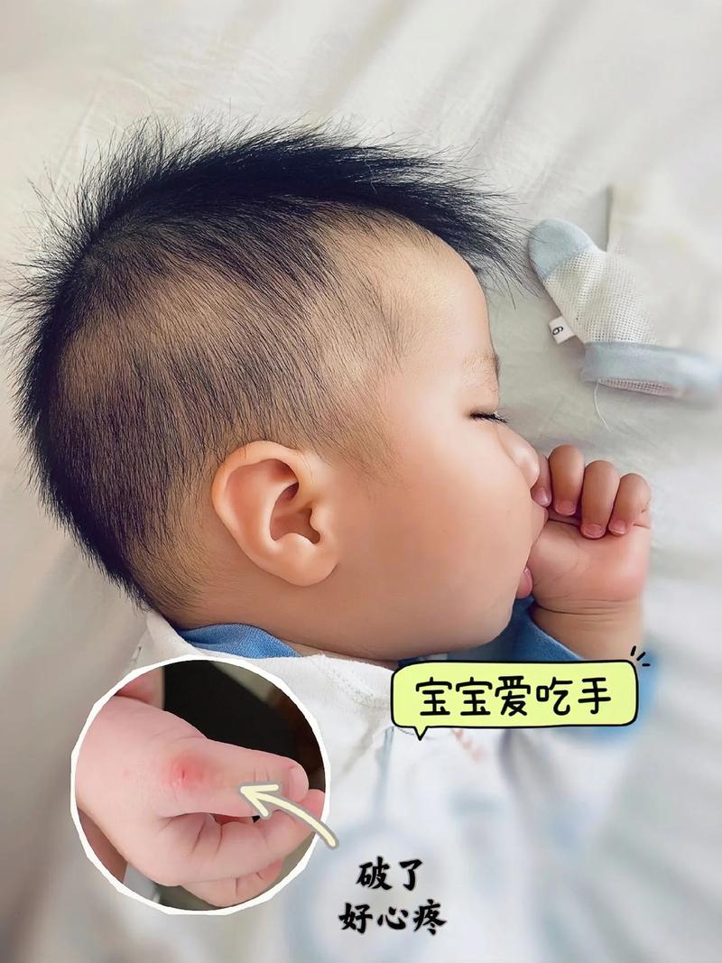 新生儿吃手是发育信号吗？不同月龄该不该干预？-第2张图片-郑州医学网