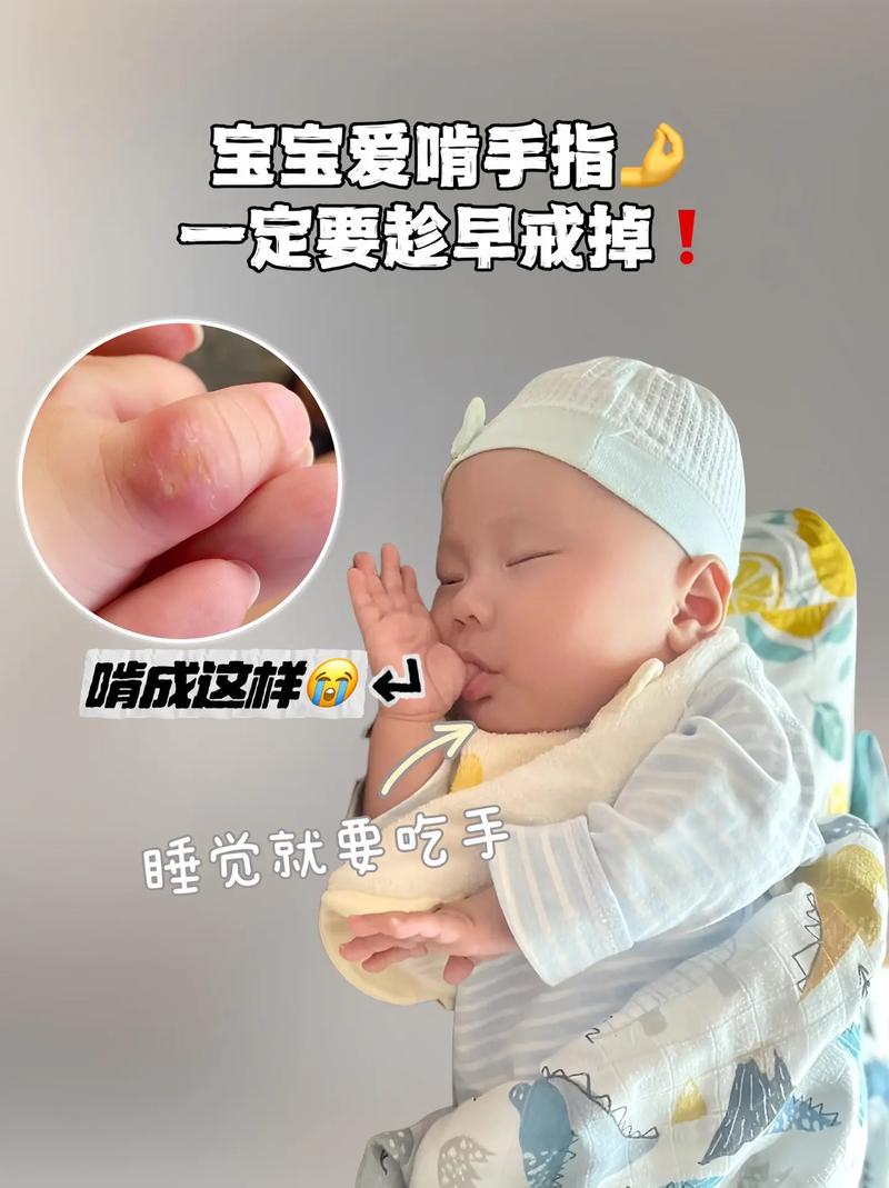 新生儿吃手是发育信号吗？不同月龄该不该干预？-第3张图片-郑州医学网