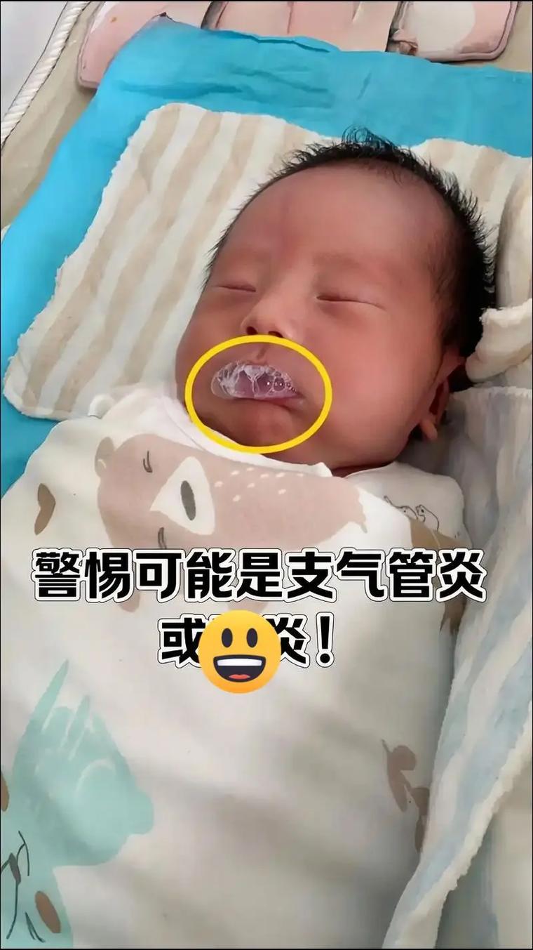 新生儿嘴里吐泡泡是正常现象还是疾病信号?需警惕哪些潜在问题?-第2张图片-郑州医学网 新生儿嘴里吐泡泡是正常现象还是疾病信号?需警惕哪些潜在问题?-第2张图片-郑州医学网