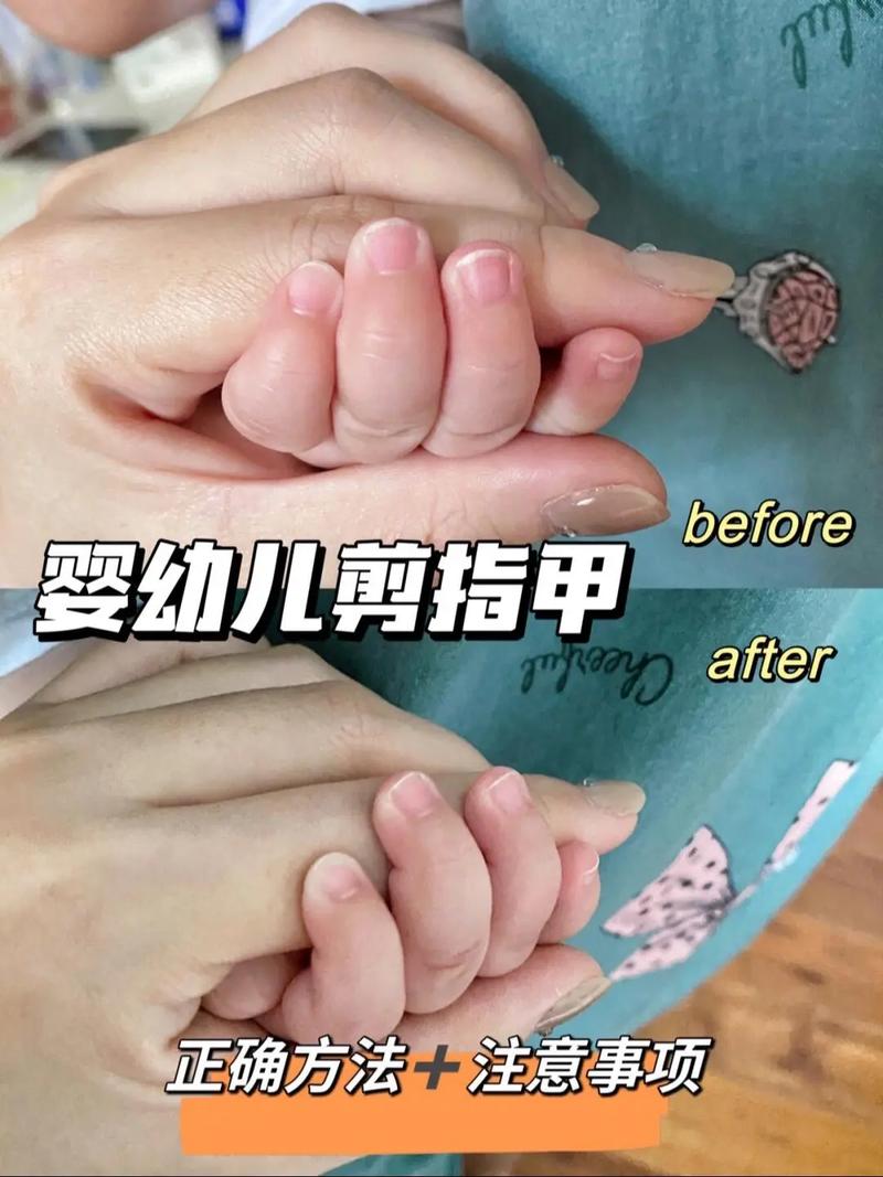 新生儿指甲到底什么时候剪才安全？新手爸妈必知的剪指甲时间与技巧！-第1张图片-郑州医学网