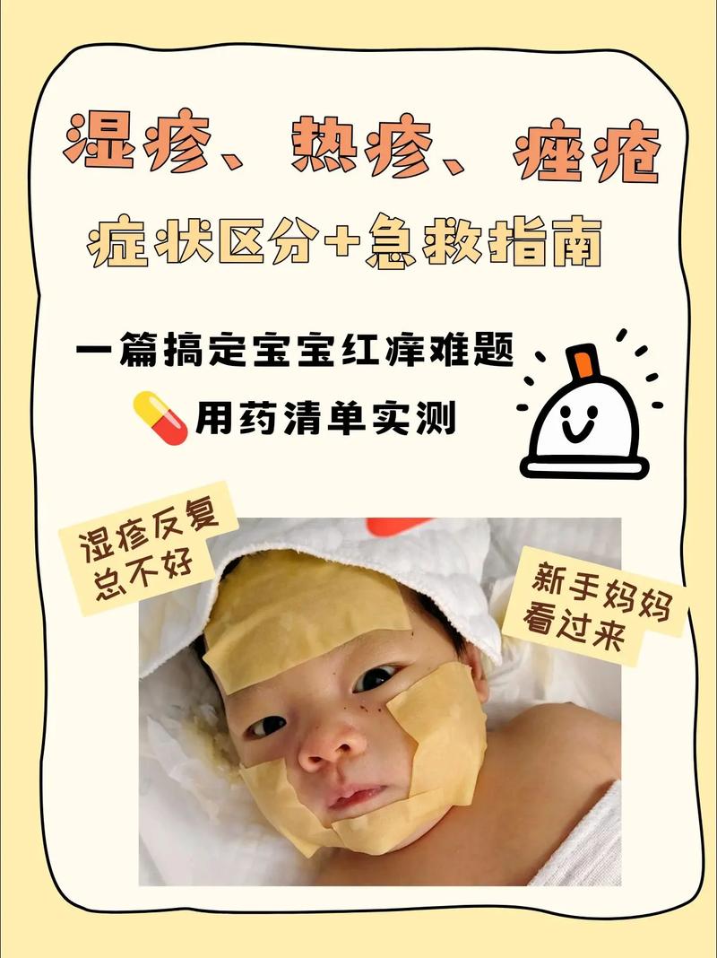 新生儿脸上长痱子怎么快速消退？日常护理要注意这几点！-第2张图片-郑州医学网