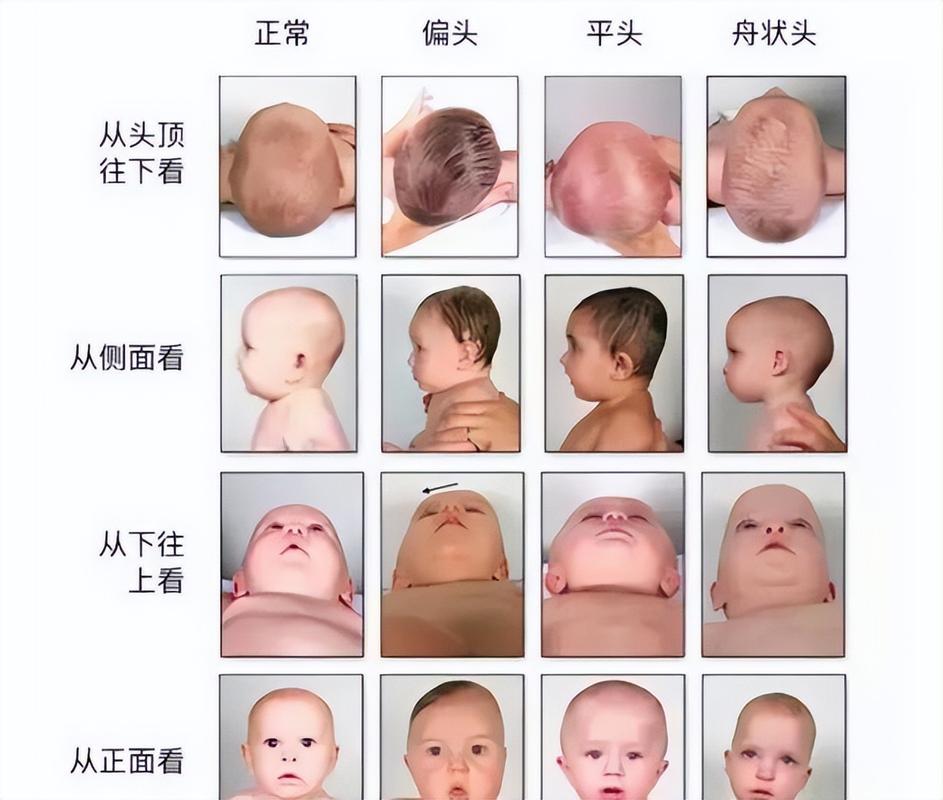 新生儿多久能稳稳竖抱抬头?头部发育关键期与竖抱注意事项有哪些?-第1张图片-郑州医学网 新生儿多久能稳稳竖抱抬头?头部发育关键期与竖抱注意事项有哪些?-第1张图片-郑州医学网