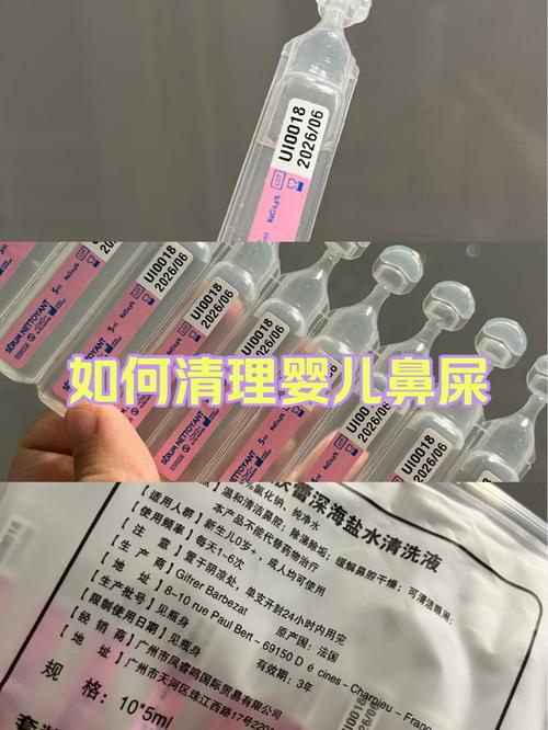 新生儿鼻屎堵塞呼吸怎么办?安全清理方法有哪些?-第2张图片-郑州医学网 新生儿鼻屎堵塞呼吸怎么办?安全清理方法有哪些?-第2张图片-郑州医学网