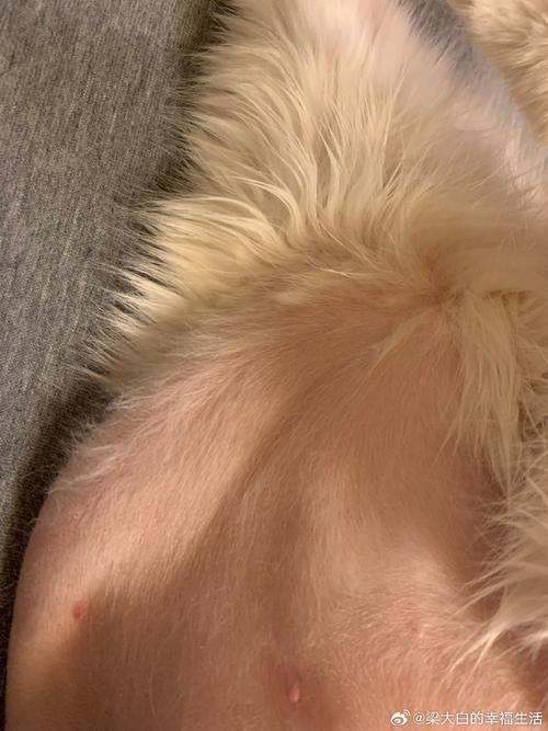 孕期肚子上毛突然增多，是激素变化还是异常信号？需要担心吗？-第2张图片-郑州医学网