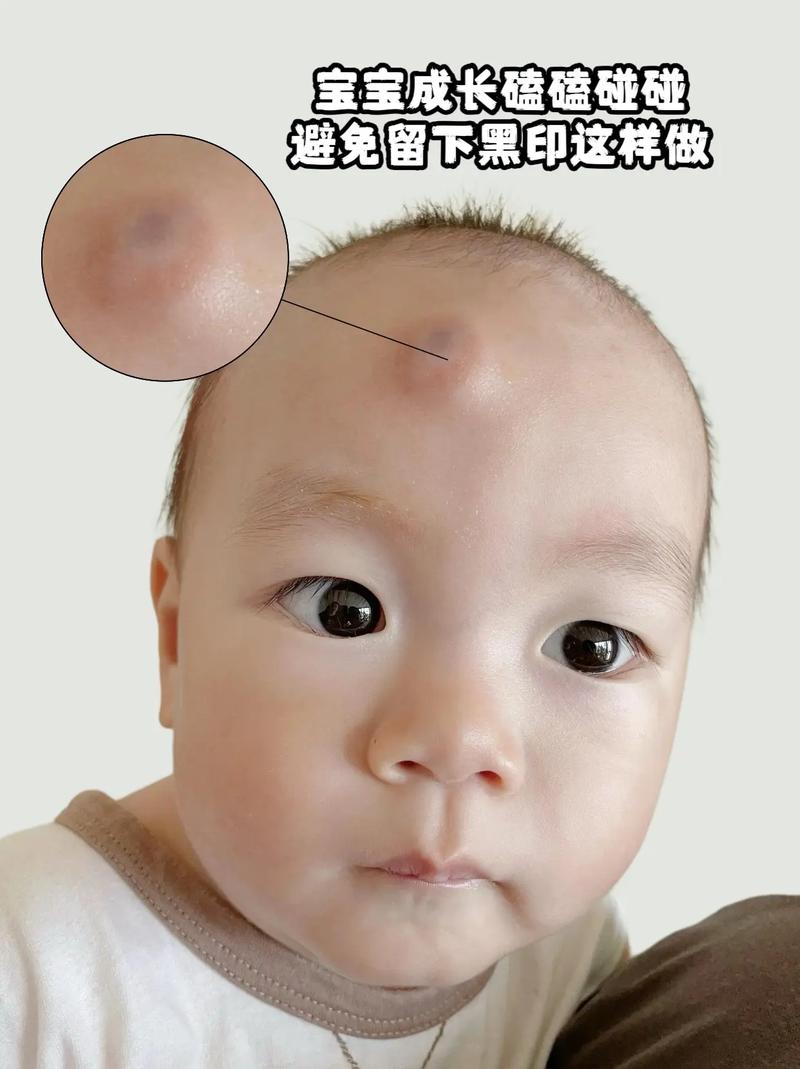 新生儿大脑缺氧后遗症会影响孩子未来的哪些能力?如何早期发现与干预?-第3张图片-郑州医学网 新生儿大脑缺氧后遗症会影响孩子未来的哪些能力?如何早期发现与干预?-第3张图片-郑州医学网