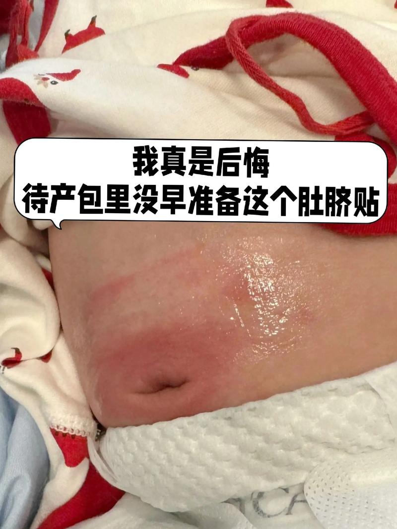 新生儿肚脐长脓是感染了吗？该如何正确处理和护理？-第2张图片-郑州医学网