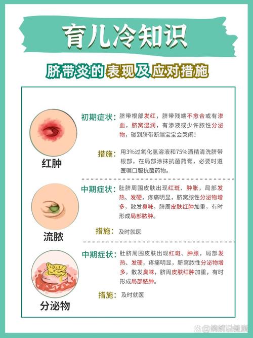 新生儿肚脐长脓是感染了吗？该如何正确处理和护理？-第1张图片-郑州医学网