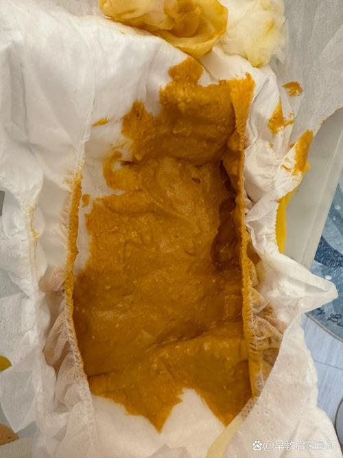 新生儿拉的粑粑有点稀，是正常现象还是消化不良的信号？-第2张图片-郑州医学网