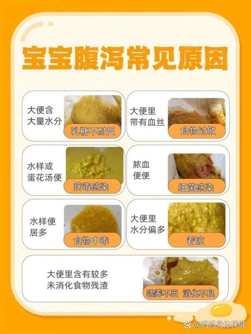 新生儿拉肚子是细菌感染吗？如何判断与应对？-第1张图片-郑州医学网