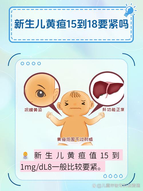 新生儿黄疸消退后还会复发吗？这些情况家长要警惕！-第3张图片-郑州医学网