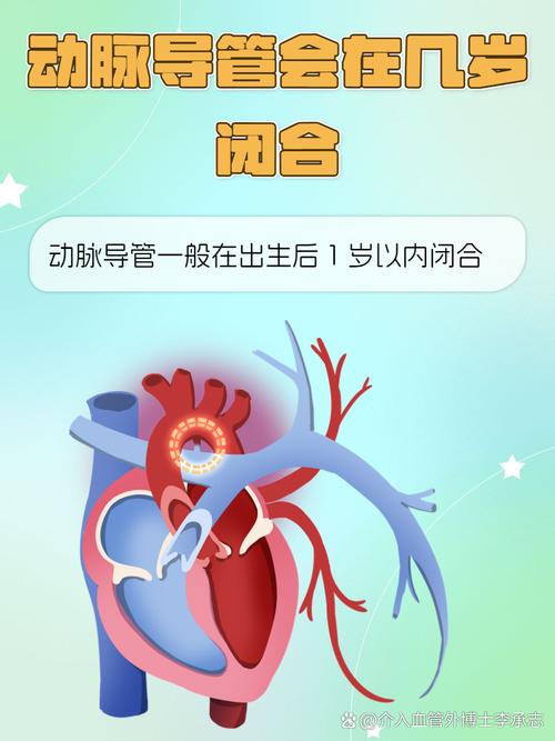 新生儿动脉导管未闭会导致哪些健康风险？如何判断与处理？-第1张图片-郑州医学网