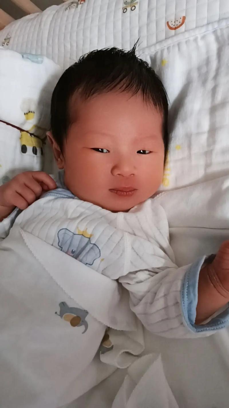 新生儿11天黄疸19mg/dl需要立即干预吗？母乳喂养会影响黄疸消退吗？-第1张图片-郑州医学网