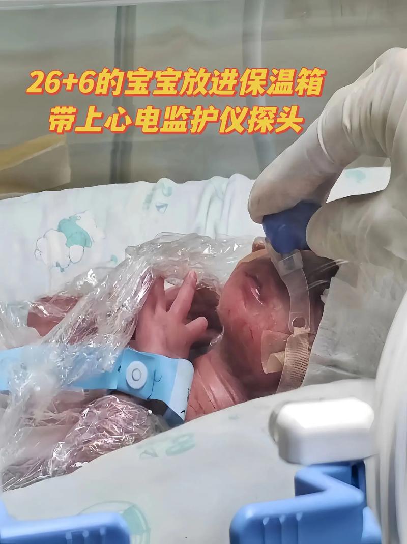 新生儿机械通气护理中,如何平衡有效通气与并发症预防?-第3张图片-郑州医学网 新生儿机械通气护理中,如何平衡有效通气与并发症预防?-第3张图片-郑州医学网