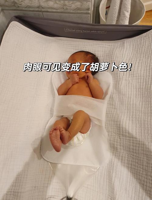 新生儿黄疸蓝光治疗安全吗?家长最关心的副作用与护理要点有哪些?-第2张图片-郑州医学网 新生儿黄疸蓝光治疗安全吗?家长最关心的副作用与护理要点有哪些?-第2张图片-郑州医学网