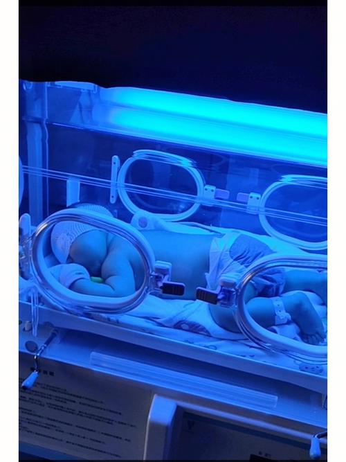 新生儿黄疸蓝光治疗安全吗?家长最关心的副作用与护理要点有哪些?-第1张图片-郑州医学网 新生儿黄疸蓝光治疗安全吗?家长最关心的副作用与护理要点有哪些?-第1张图片-郑州医学网