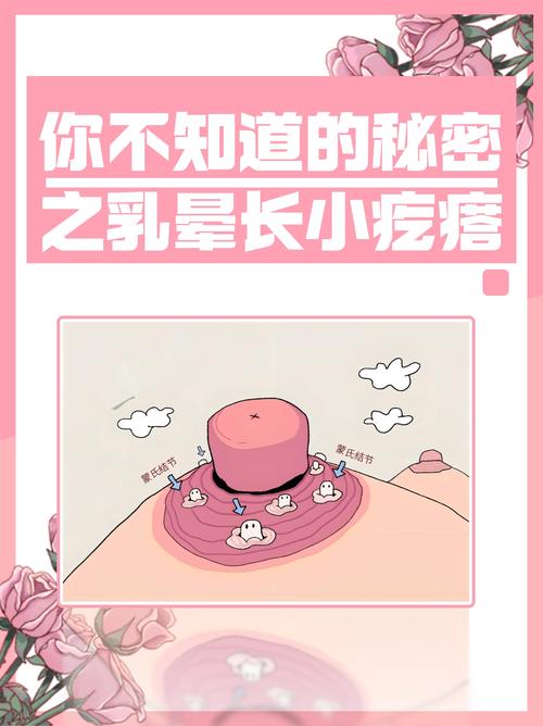 孕期乳晕长了小肉疙瘩-第2张图片-郑州医学网