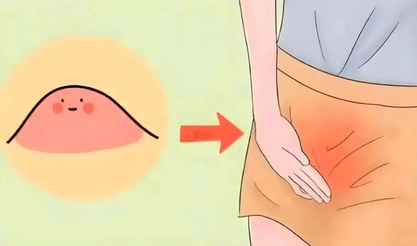 孕期外阴长了小疙瘩痒-第2张图片-郑州医学网