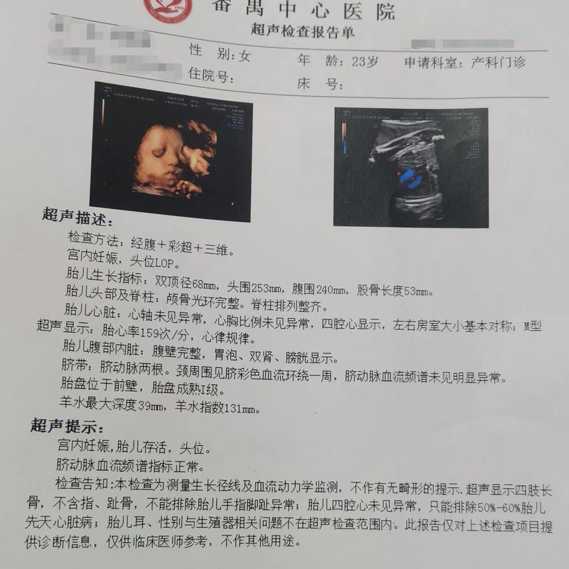 孕期小排畸具体检查哪些胎儿畸形？三维还是四维更清晰？-第2张图片-郑州医学网