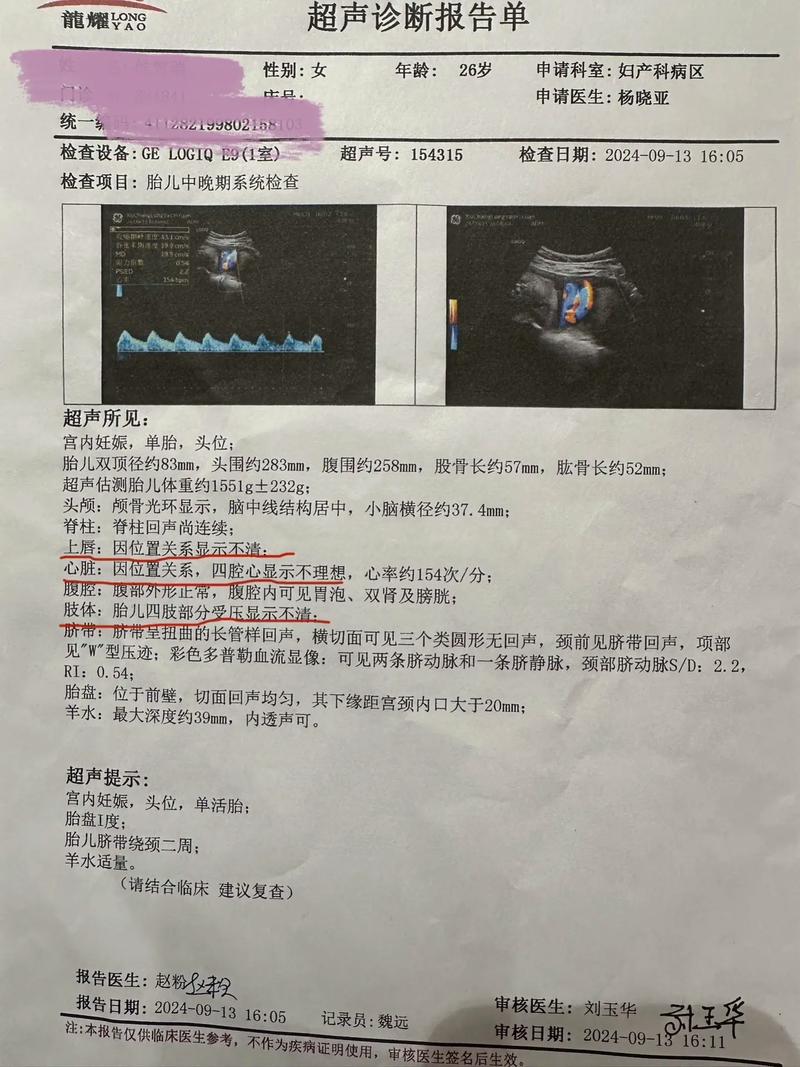 孕期小排畸具体检查哪些胎儿畸形？三维还是四维更清晰？-第3张图片-郑州医学网