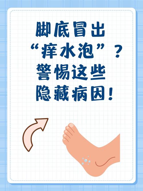 孕期脚丫莫名起泡是缺营养还是生病了？孕妈该如何应对才安全？-第3张图片-郑州医学网
