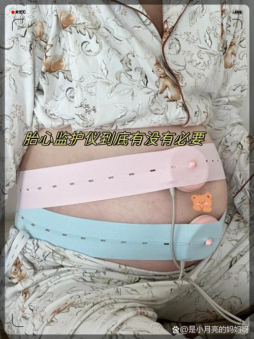 孕期胎心监护到底要做几次？不同孕周频率有何差异？-第3张图片-郑州医学网