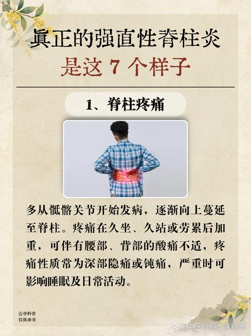 儿童强直性脊柱炎症状-第3张图片-郑州医学网