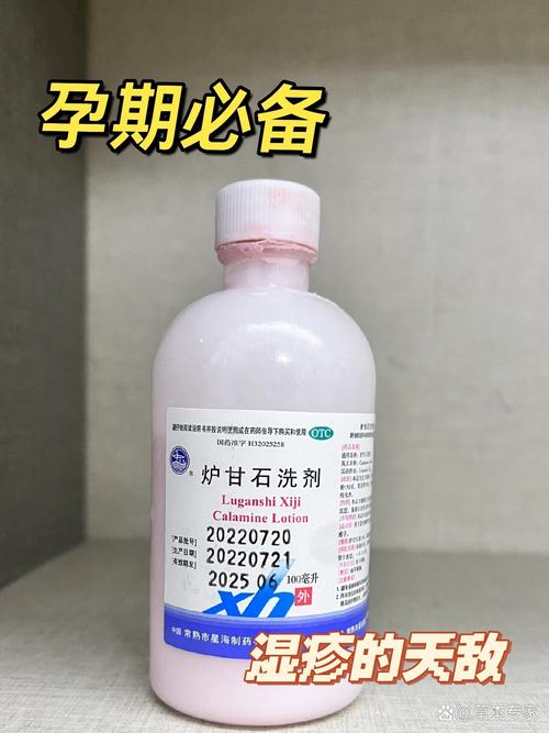 孕期湿疹可以喝中药吗-第1张图片-郑州医学网