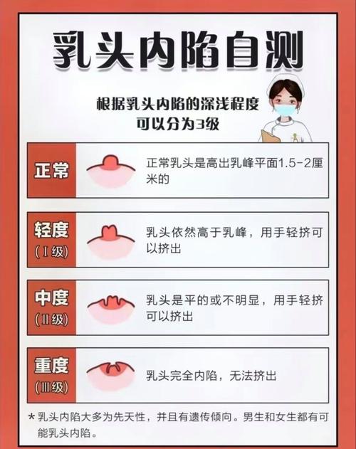 孕期乳头正常图片大全-第1张图片-郑州医学网