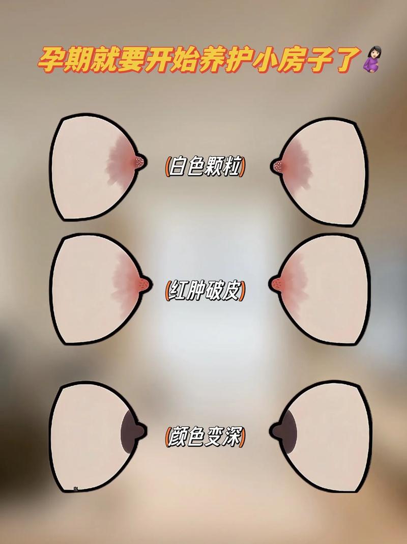 孕期乳头正常图片大全-第2张图片-郑州医学网