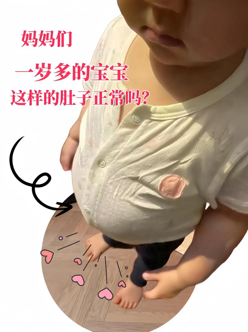 正常的新生儿肚子照片-第3张图片-郑州医学网