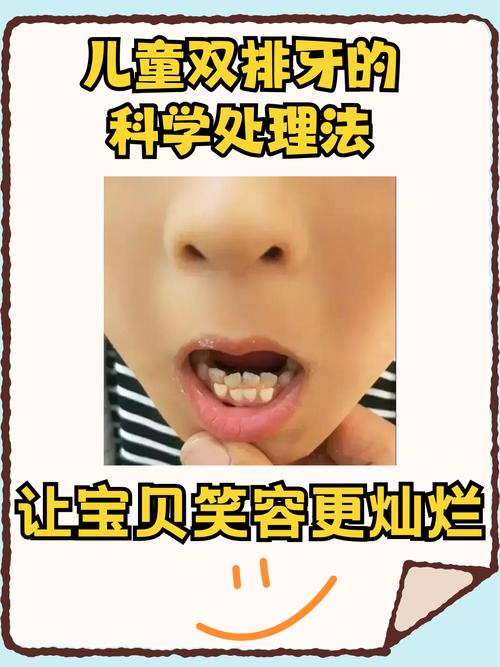 儿童上牙床突出是什么原因导致的？需要怎么矫正呢？-第2张图片-郑州医学网