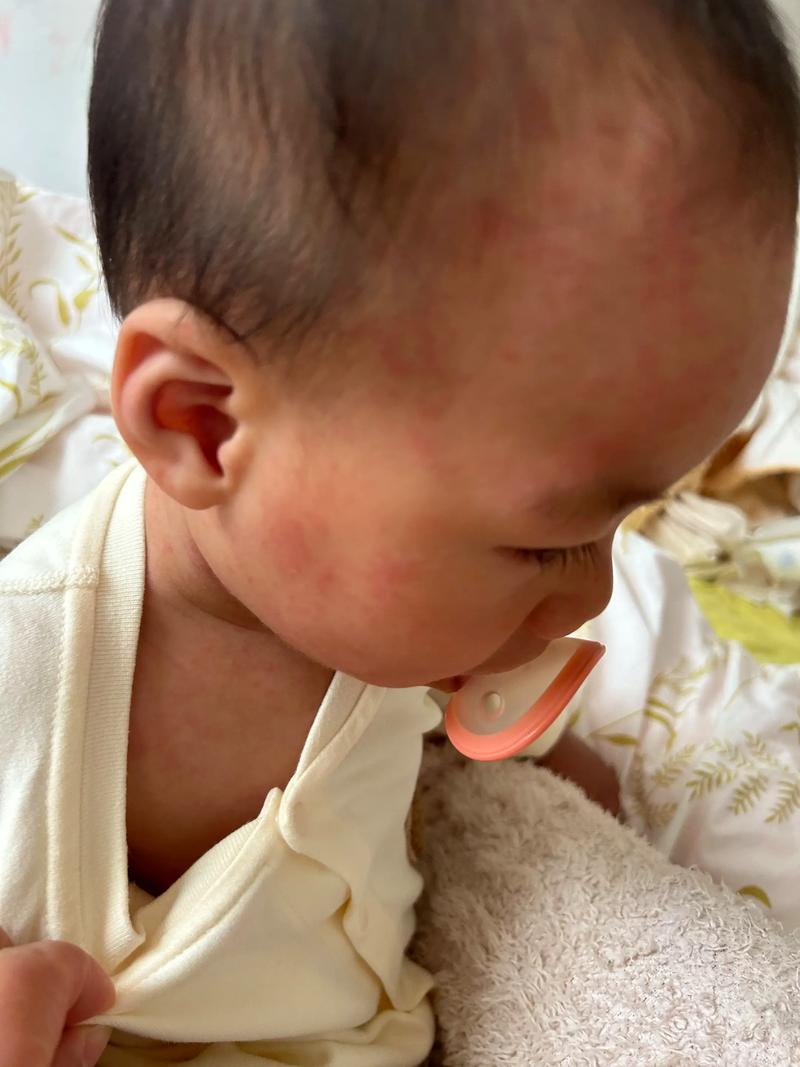 新生儿发烧38.5℃必须立即吃药吗？物理降温怎么做才有效？-第2张图片-郑州医学网