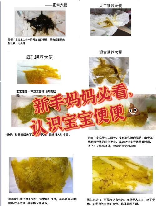 新生儿 大便 10次-第3张图片-郑州医学网