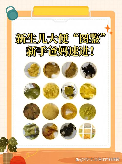 新生儿 大便 10次-第1张图片-郑州医学网