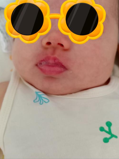 新生儿一个多月总吐泡泡是正常现象还是疾病信号？需警惕哪些潜在问题？-第2张图片-郑州医学网