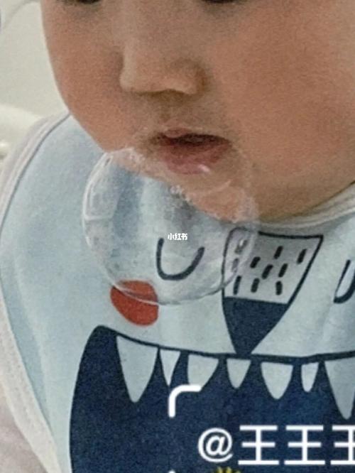 新生儿一个多月总吐泡泡是正常现象还是疾病信号？需警惕哪些潜在问题？-第3张图片-郑州医学网