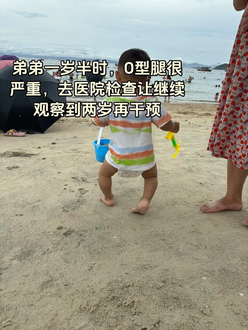 新生儿小腿肌肉粗细不一,是发育异常还是正常现象?-第2张图片-郑州医学网 新生儿小腿肌肉粗细不一,是发育异常还是正常现象?-第2张图片-郑州医学网