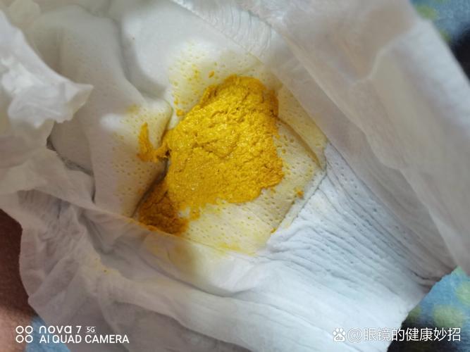 新生儿吃母乳拉黄水是正常现象还是消化问题？-第1张图片-郑州医学网