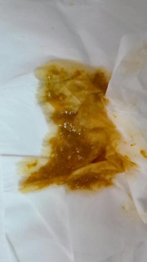 新生儿吃母乳拉黄水是正常现象还是消化问题？-第2张图片-郑州医学网