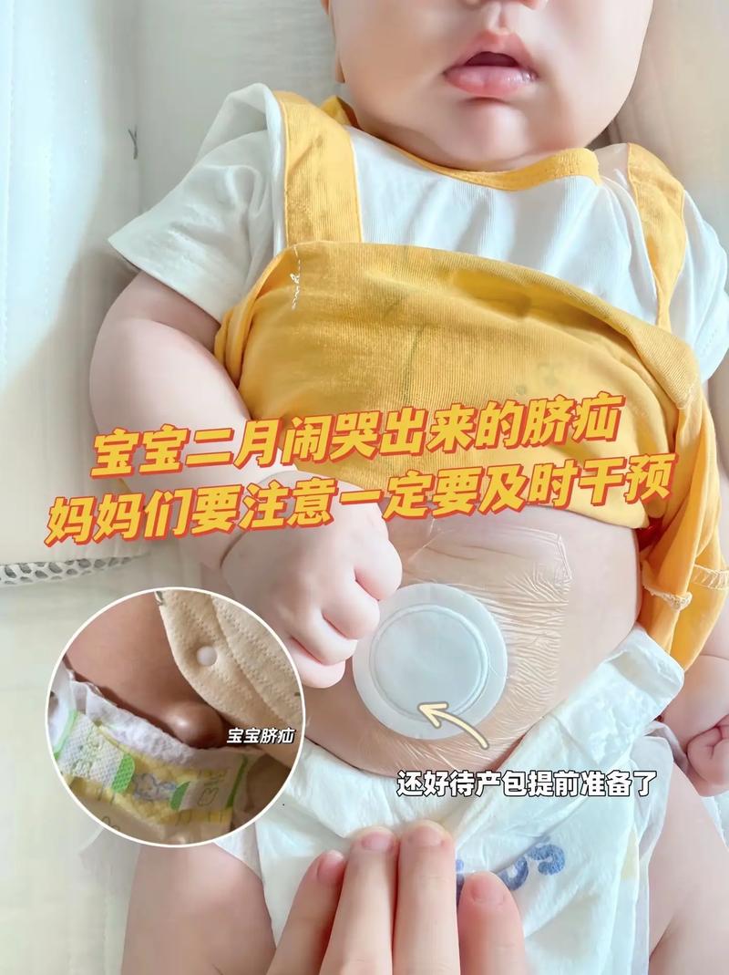 新生儿疝气卡了怎么办-第2张图片-郑州医学网