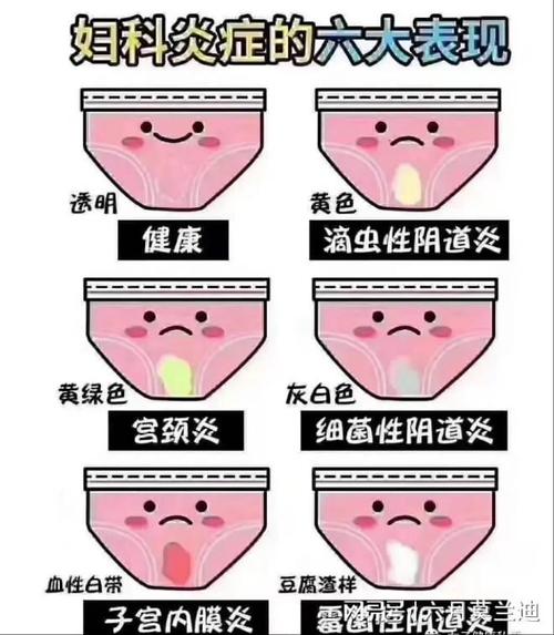 孕期患上滴虫性阴道炎，对胎儿有影响吗？该如何安全治疗？-第1张图片-郑州医学网